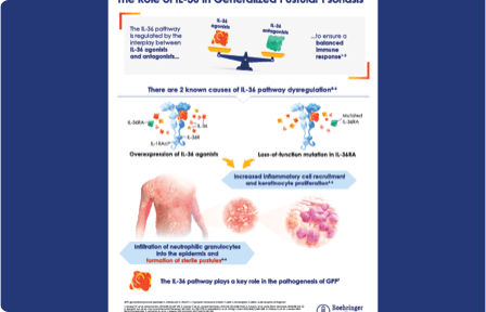Learn more about the IL-36  pathway