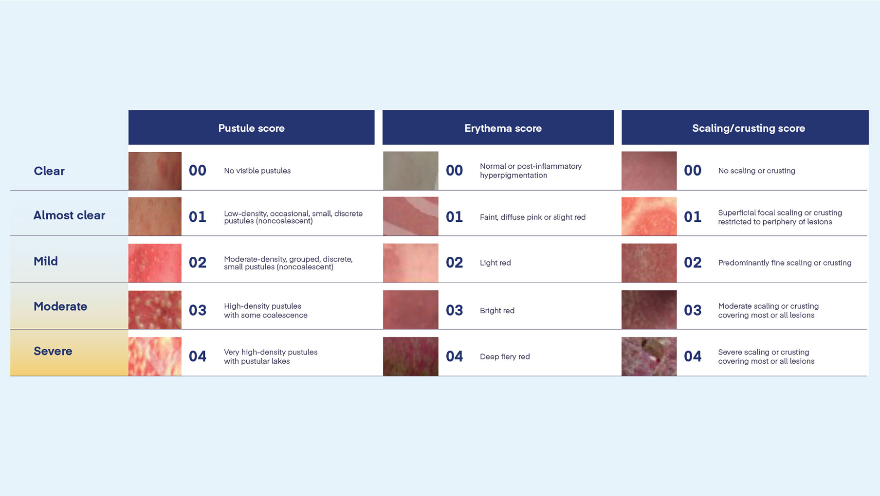GPPGA Scoring Tool Guide